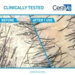 CeraVe Hydrating Anti Dandruff Shampoo, Itchy Scalp Treatment, 12oz - Image 3